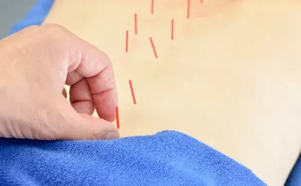 Q. 治療は痛くないのですか？